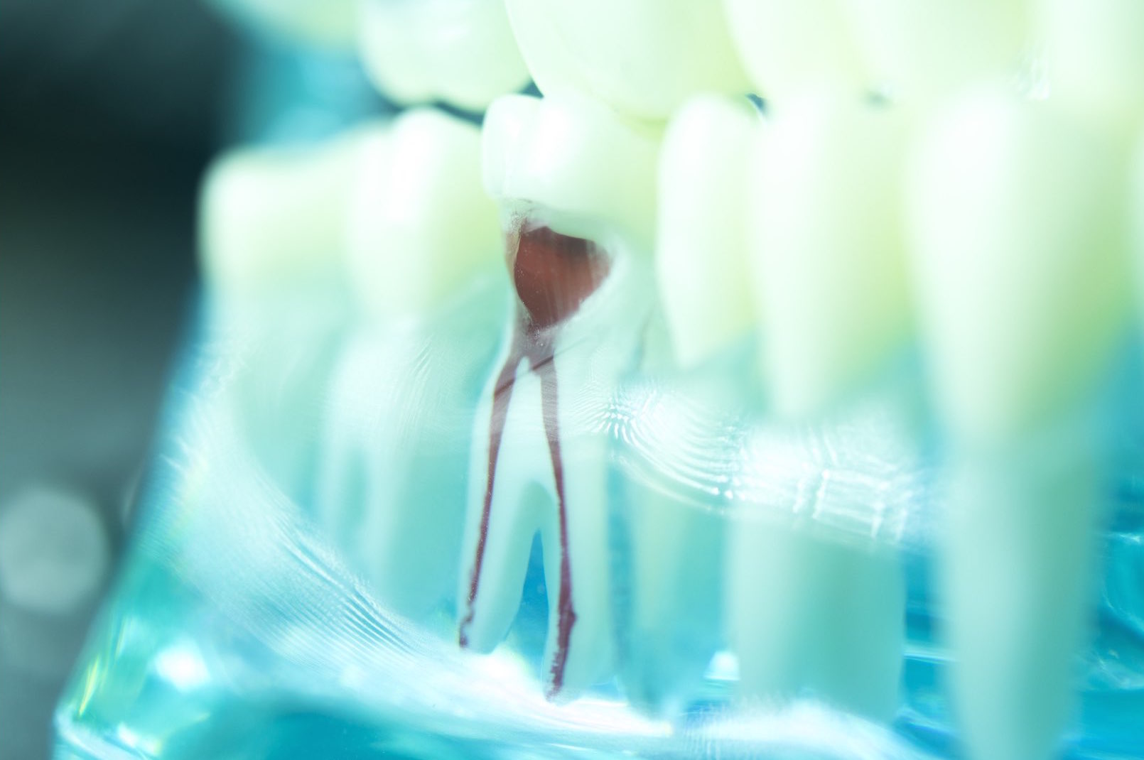 Root canal treatment FAQs